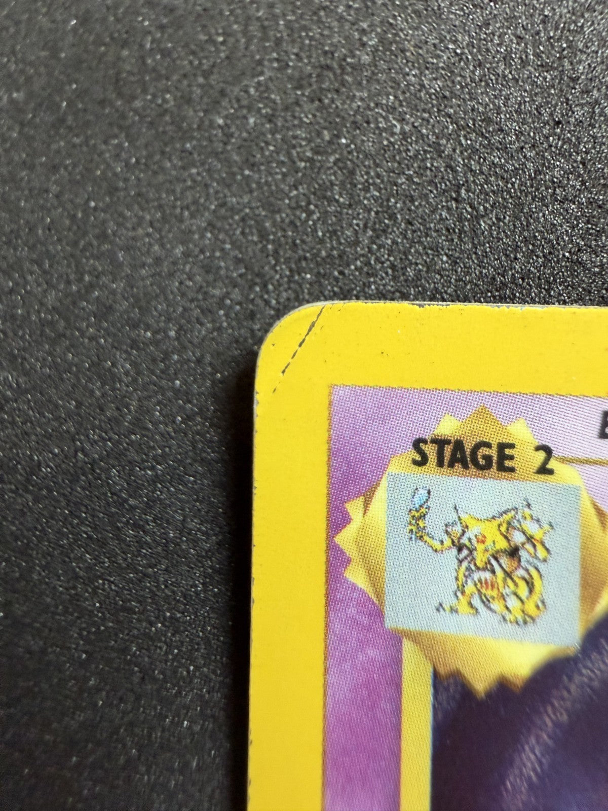 Alakazam 1/102 Base Set Unlimited Holo Pokemon - MP